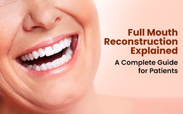 full mouth reconstruction in Kolkata