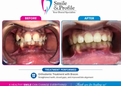 Before & After