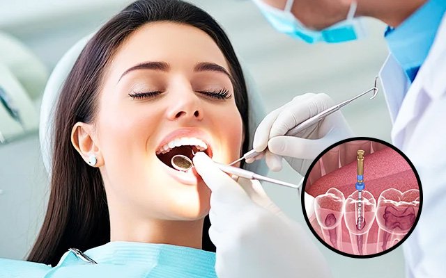 When Need Root Canal Treatment?