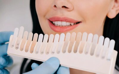 Why Do Teeth Become Darker With Age? Understanding Teeth Whitening