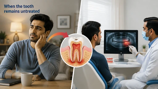 How Does a Tooth Infection Actually Spread If Left Untreated?